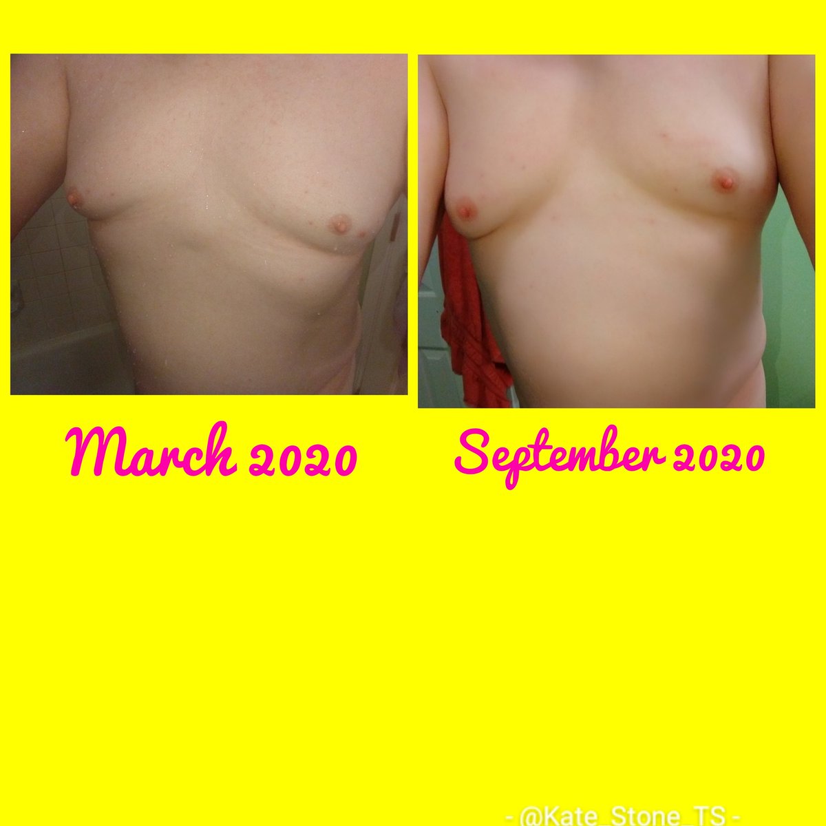 Kate_Stone_TS's tweet photo. Growing

I love having cleavage!

#boobs #transboobs #tgirl #tgirlboobs #trans #maturetrans #transtitties 
#transgender #transwoman #mtf #tsgirl #trans #tsgirls #tgirl #myboobs #transisbeautiful https://t.co/zxxFepmZV9