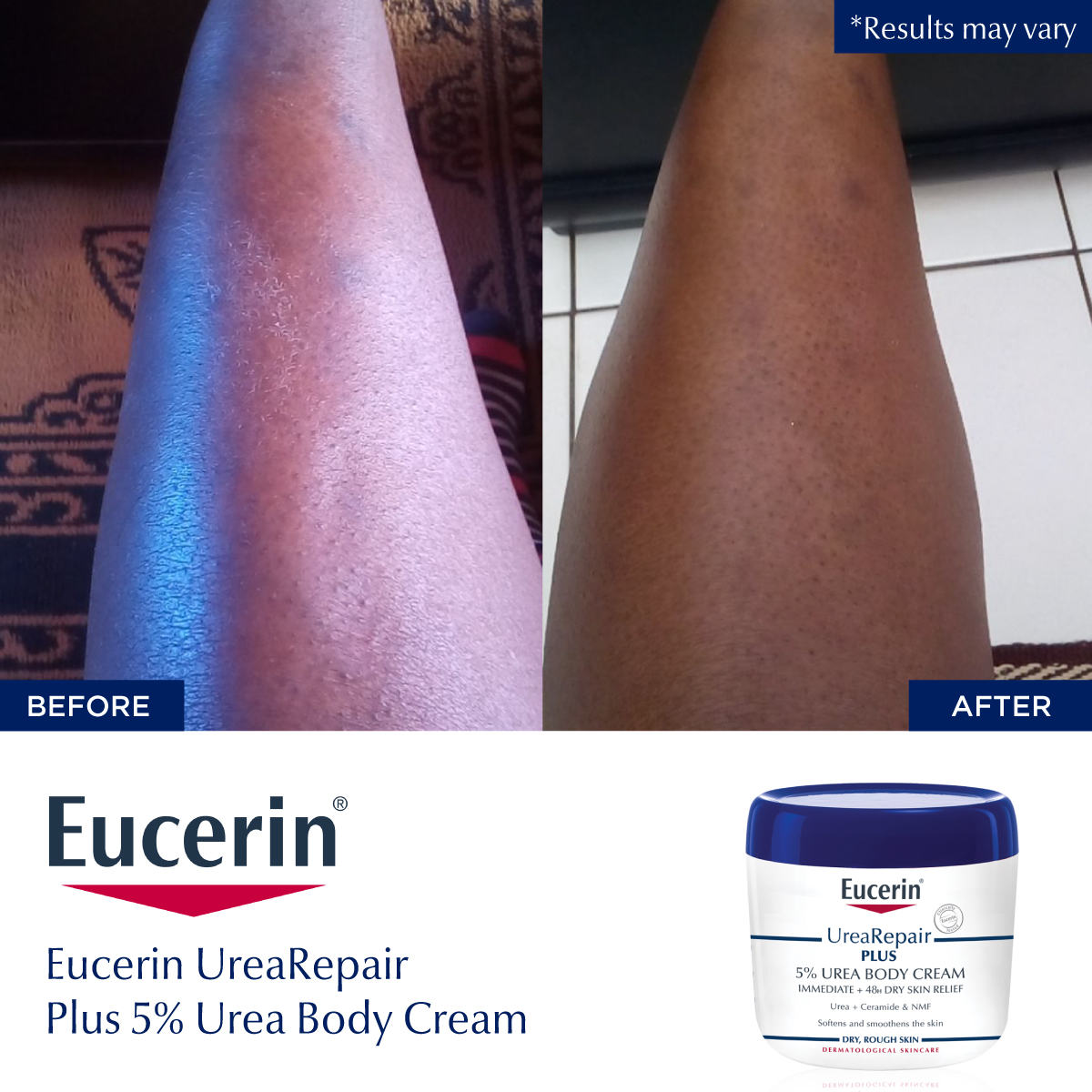 rubybox_beauty's tweet photo. Can't help but look twice at these incredible transformations thanks to the Eucerin UreaRepair Plus 5% Urea Body Cream. Can you believe this is only 4 weeks of use!!
#EucerinSA #UreaGold #rubybox #rubyboxureagold https://t.co/DMSxusZoct