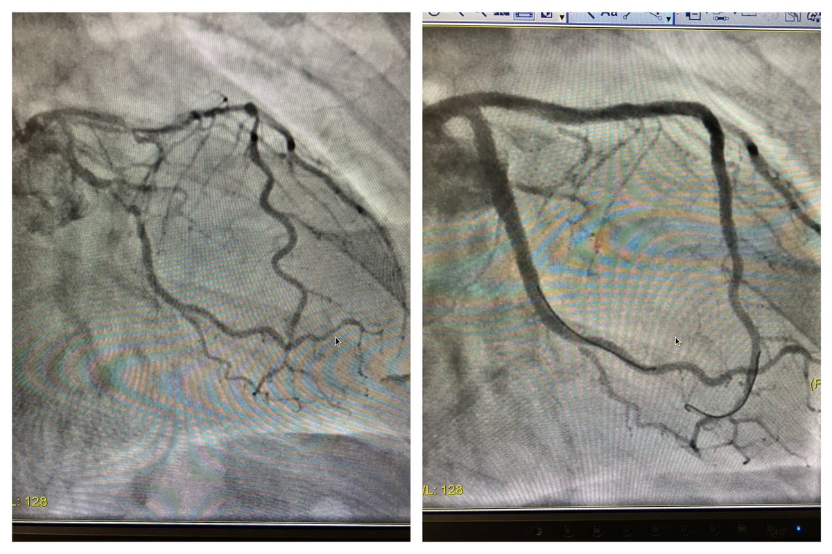 Evandro Martins F. MD tweet media