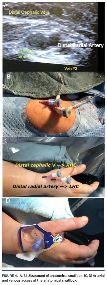 Hady Lichaa, MD, FACC, FSCAI, FSVM, RPVI tweet media