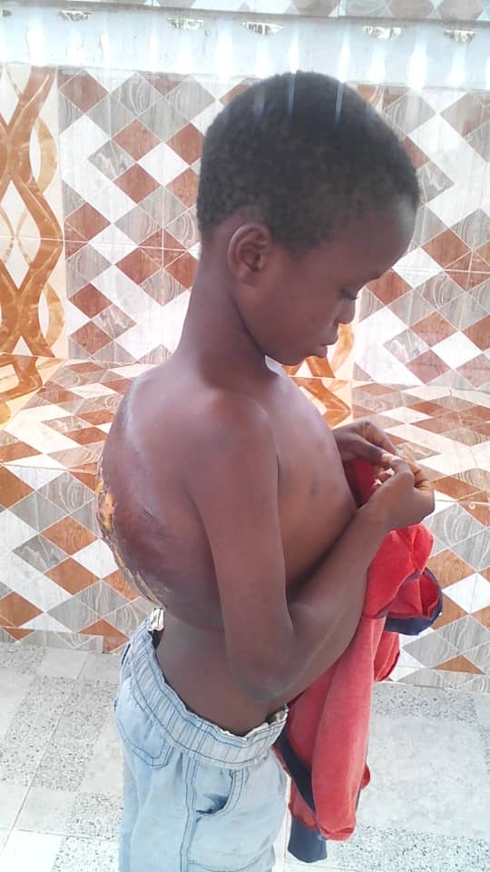 Asanteclickwise's tweet photo. @hughes_onair Pls help save the life of this seven year old kid. He will forever own you his dear life #LetsDoItForStephen https://t.co/WEo2iyG8wM
