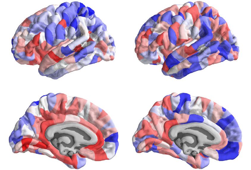 BCI_ABA's tweet photo. "A new study pinpoints genes and cell types that may account for the atypical brain structure in people with genetic conditions related to autism." #autismnews #autismsawareness #learnprovidernetwork https://t.co/ogAFB51DKg https://t.co/hjQfDLd1cm