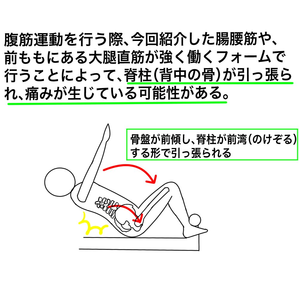 きよし2号 腹筋トレで首が痛くなってしまう場合はどうしたらよいでしょうか きよし2号 腹筋トレで首が痛くなってしまう場合はどうしたらよいでしょうか