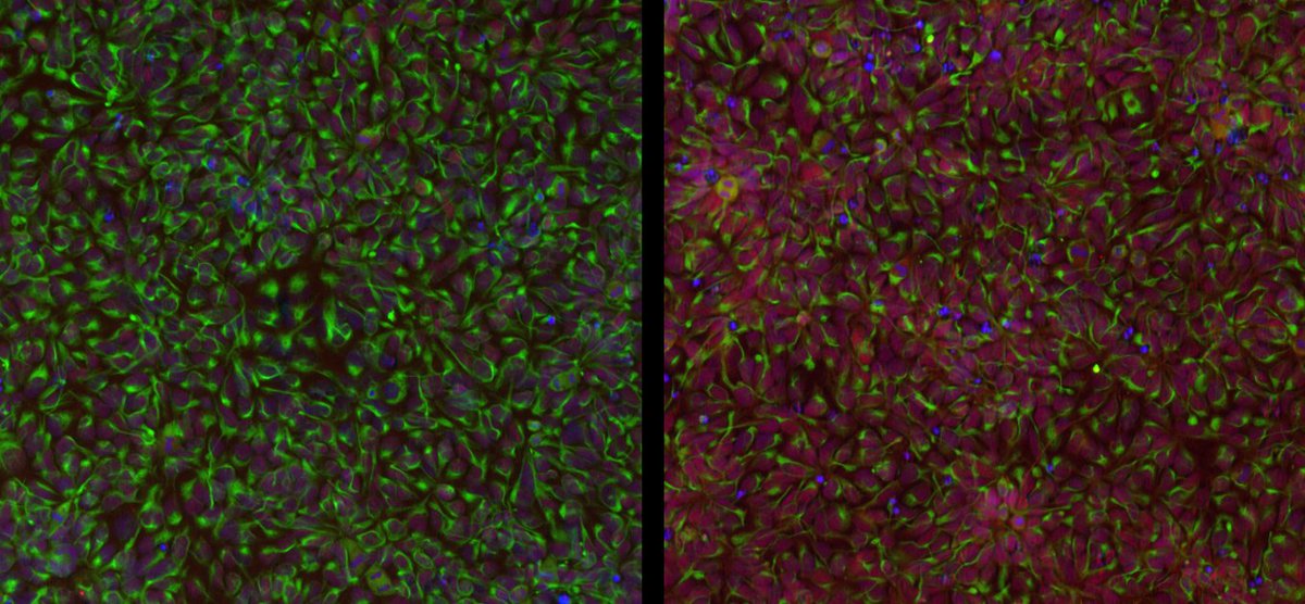 Staining #iPSC derived #neuralprogenitor cells is one of the many ways we characterise our cells. These can be matured to #neurons and provide a valuable platform for #diseasemodeling and #compoundscreening in #neurodegeneration
