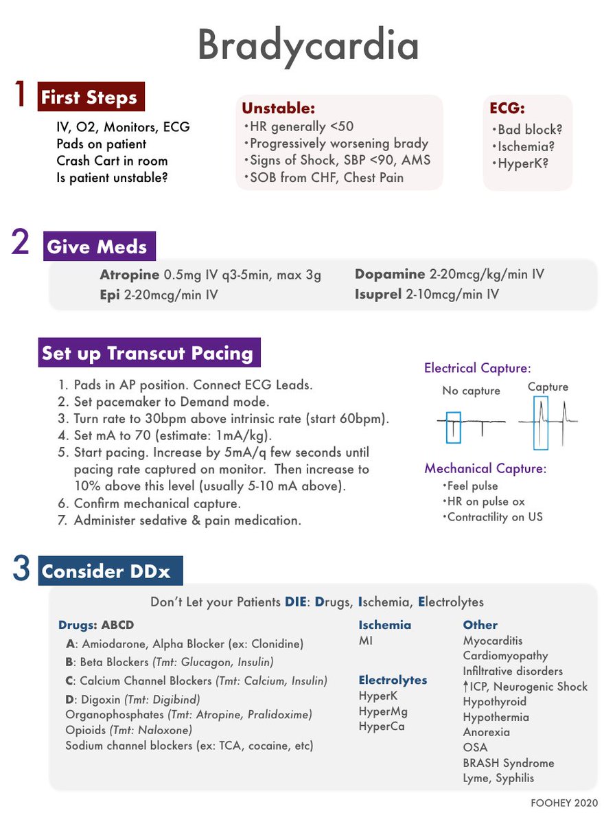 The first time I saw an unstable brady patient as an R3, I realized I knew what to do but not how to do it.  Here is my approach with some details for the less experienced (doses, how to pace, etc).  Feedback welcome!