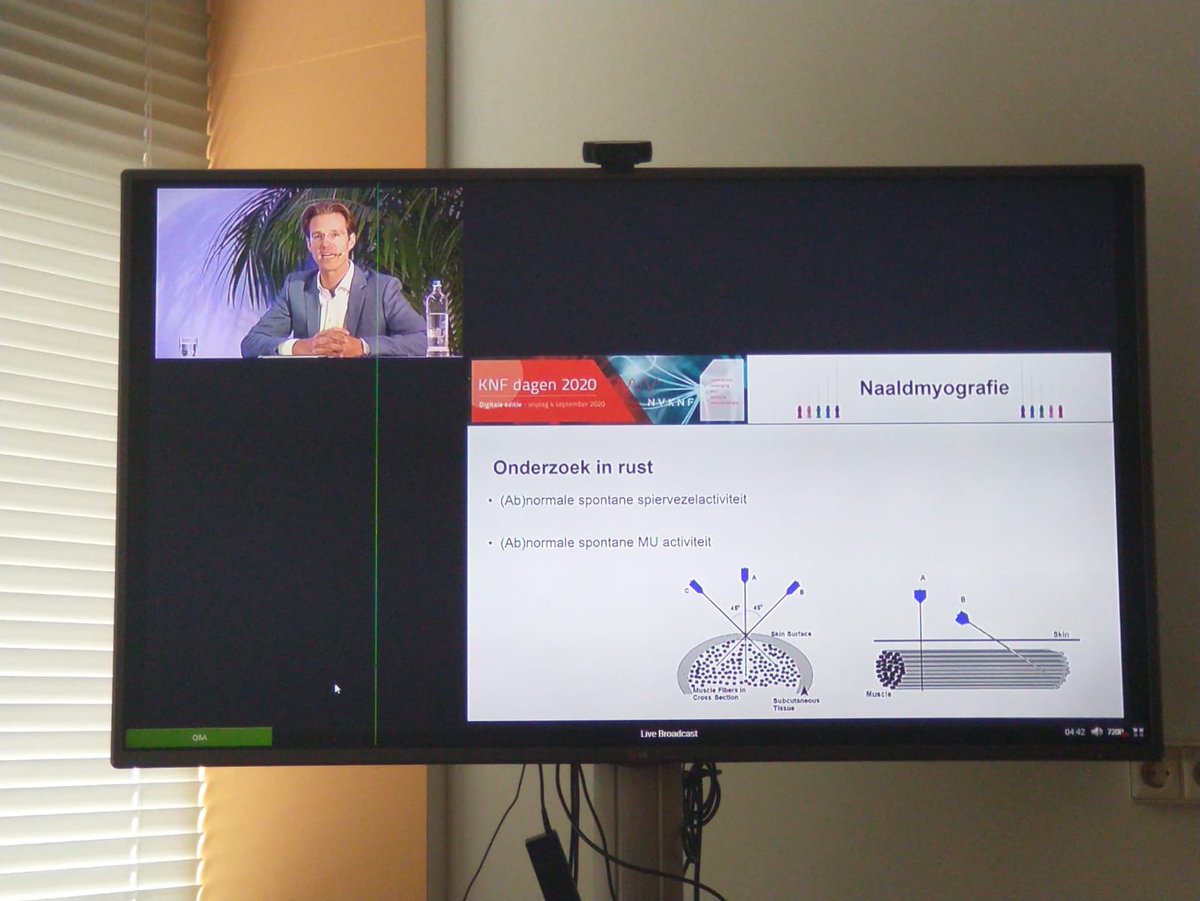 Zojuist digitale workshop naald-EMG verzorgd op de #KNFdagen