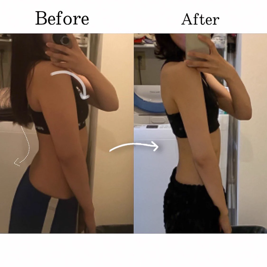 【反り腰】の方必見！！姿勢よくなることは、ダイエット成功と大きく関係している？！