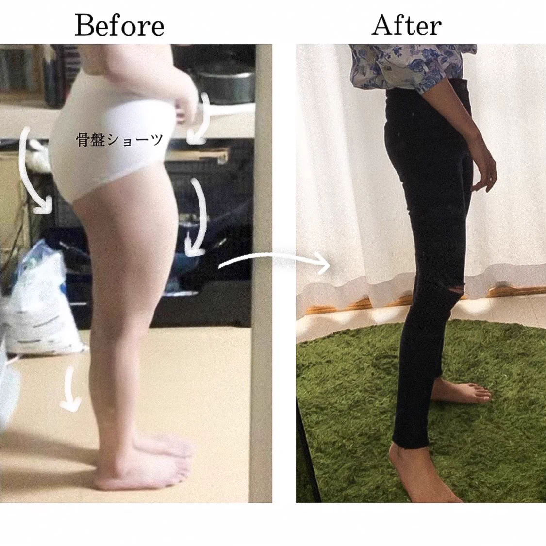 【反り腰】の方必見！！姿勢よくなることは、ダイエット成功と大きく関係している？！