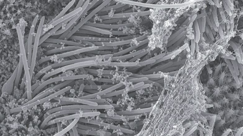 Horrifying Images Show How the Coronavirus Ravages Our Lungs buff.ly/3jIwcoQ