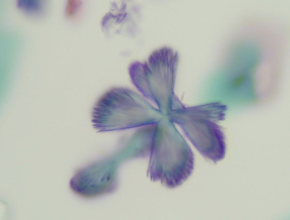 crystals in urine, or I should say butterflies and bugs????
Happy Friday :)
#CytoPath #Pathresients #CytoArt #TheMagicofCytopath