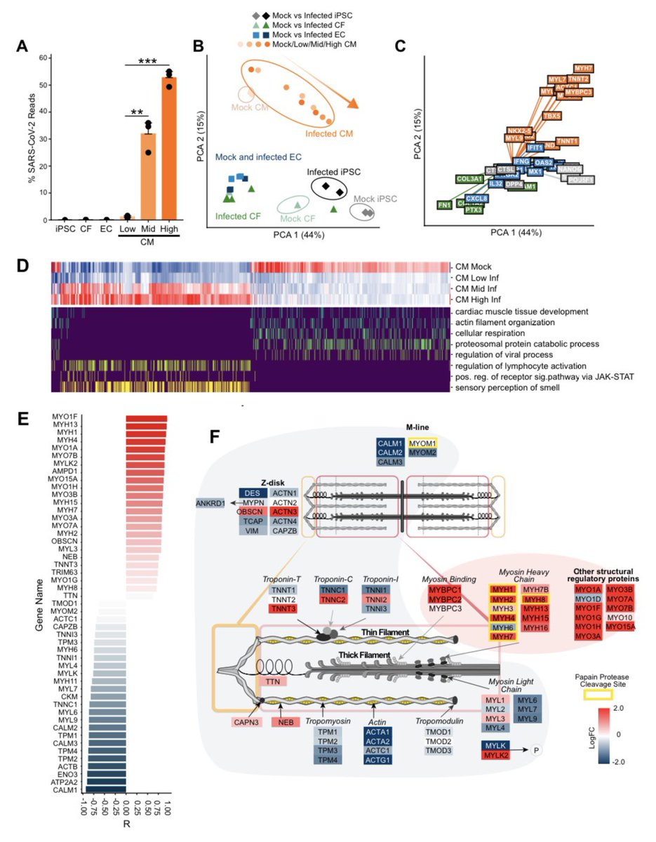IlindelatorreMD's tweet photo. Los cardiomiocitos derivados de iPSC (células madre pluripotenciales) infectados con SARS-CoV-2 revelaron firmas transcriptómicas y morfológicas sólidas de daño en cardiomiocitos. | Preprint BioRxiv. 

https://t.co/hBVgO0gRr0 https://t.co/pXNv4ttdff