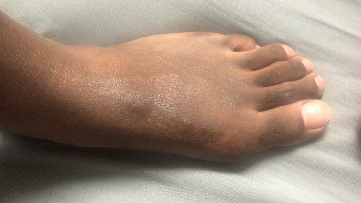 LaAnthony Valentine tweet media