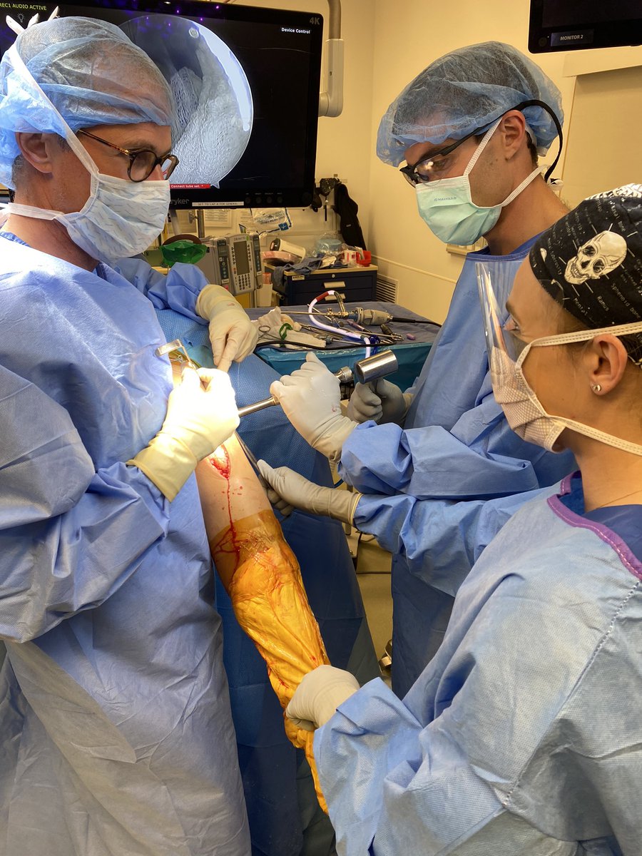 VolkerMusahl's tweet photo. Great ACL done today with help from PGY-3 @emtheeph and fellow @B_GodshawMD ! Guess you could call it a #joint effort ๐ #quadtendon #womanpower #STABILITYII https://t.co/Y1cKUJkqFW