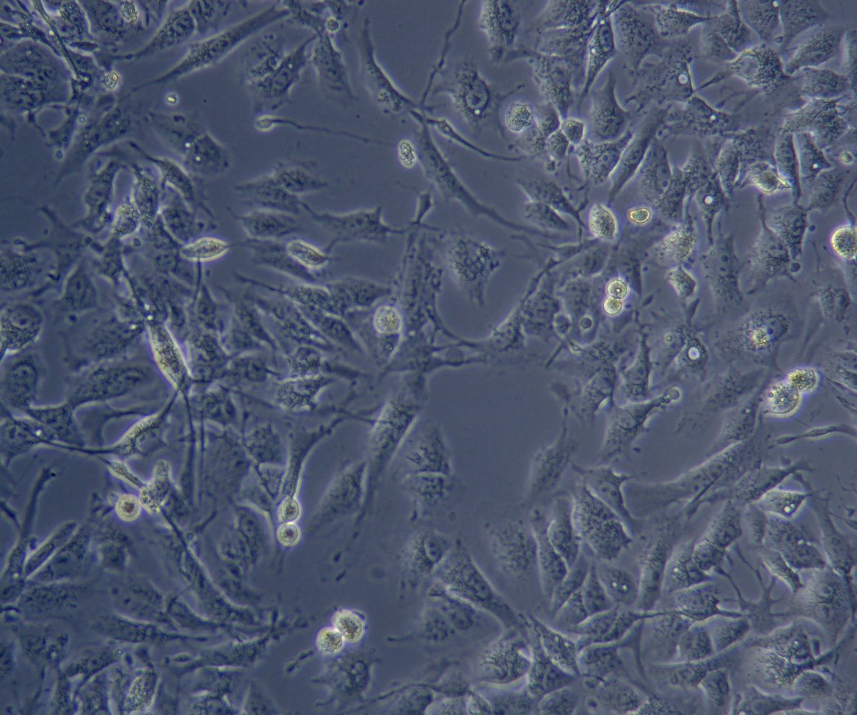 reyhan_ulugol's tweet photo. Happy Hour for the cells on Collagen Coating :)
Tight junctions of the Classical hexagonal HepG2 appereance turns into a fibroblast-like form on collagen coating #hepg2 #microenvironment #invertedmicroscope #mükkam
Photo by Reyhan Ulugol https://t.co/DbOuW1MS8b