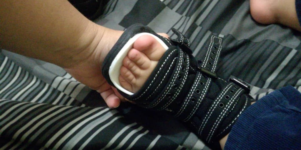 IowaBrace's tweet photo. This week's Clubfoot cutie of the week is showing off the Iowa Brace in Venezuela! Want your cutie to be the next Clubfoot cutie of the week? Send us a pic of them in their Iowa Brace! ❤️ #Clubfoot #Ponseti #ClubfootCuties #ClubfootSolutions #IowaBrace #Cutie #Venezuela https://t.co/boQweyg2C8