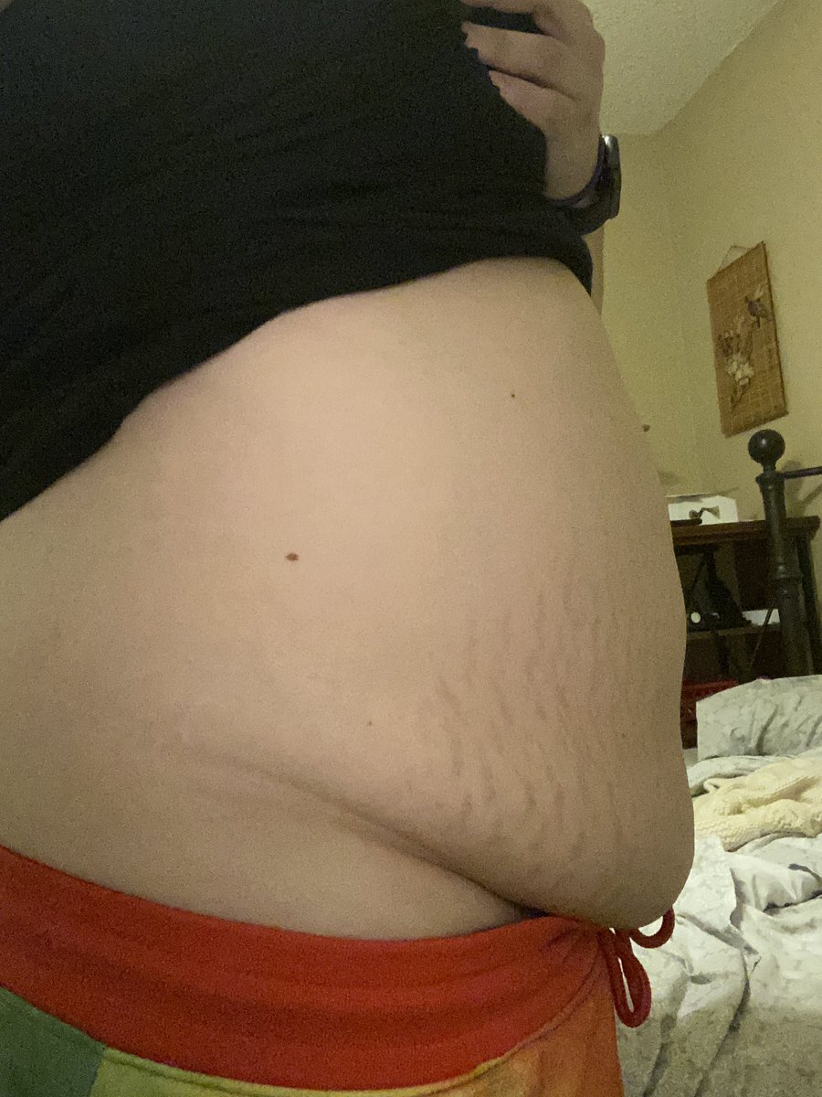 VioletSmoak's tweet photo. #5weeks #momapron #stretchmarks #AdultWork #bbwamatuer #bbw https://t.co/1iMO0jZ9vC