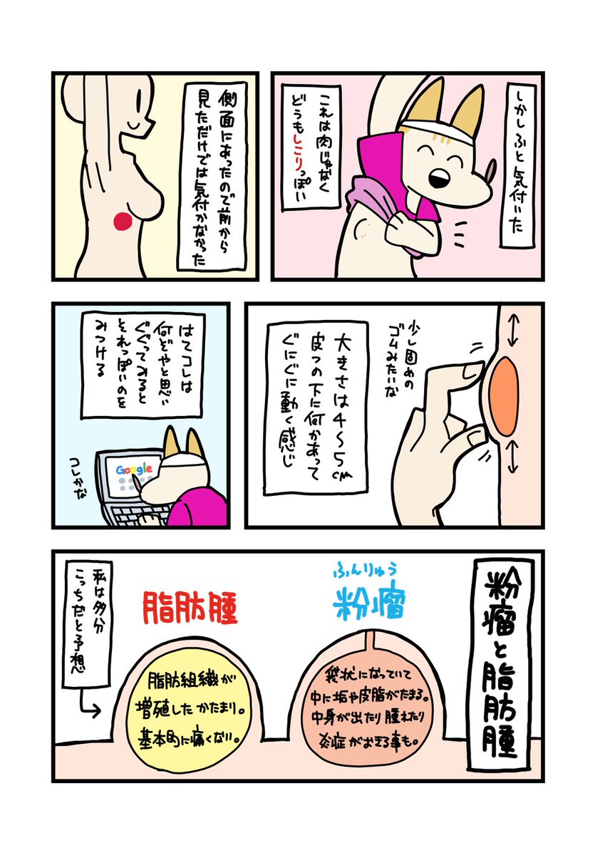 最近やってないけどリングフィットのお陰で脂肪腫が見つかったので運動大事 