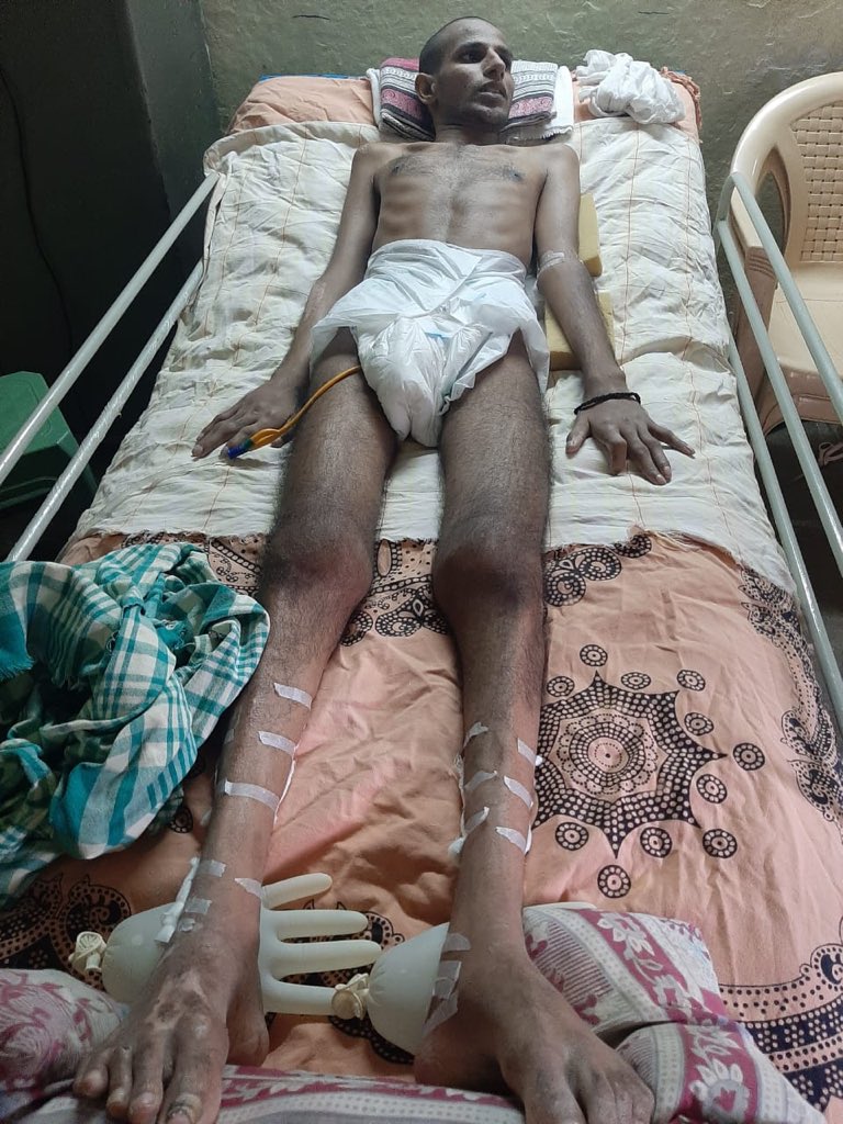 112Saipranay's tweet photo. @SonuSood sir plz help him sir *Help shashikanth to walk*

Shashikanth reddy, Age : 25  has to undergo a surgery for spine injury on 1-9-2020 and cannot afford to pay Rs 6,50,000. Kindly help him to get the surgery done he is from Moti nager ,Hyderabad , Telangana https://t.co/MJW3q8OyGG