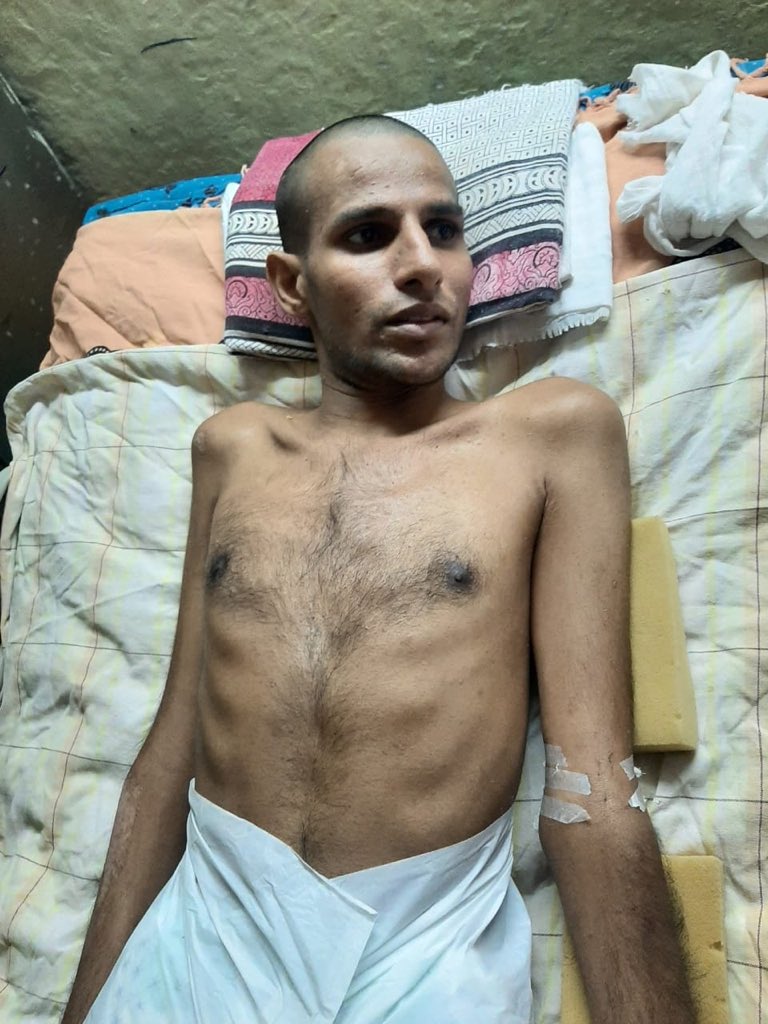 112Saipranay's tweet photo. @SonuSood sir plz help him sir *Help shashikanth to walk*

Shashikanth reddy, Age : 25  has to undergo a surgery for spine injury on 1-9-2020 and cannot afford to pay Rs 6,50,000. Kindly help him to get the surgery done he is from Moti nager ,Hyderabad , Telangana https://t.co/MJW3q8OyGG