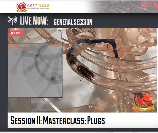 thegestgroup's tweet photo. Join Gary Siskin, MD for the GEST Masterclass demonstration on plugs.  https://t.co/ZyCY3P9Zfw https://t.co/VxSHZKwg4m
