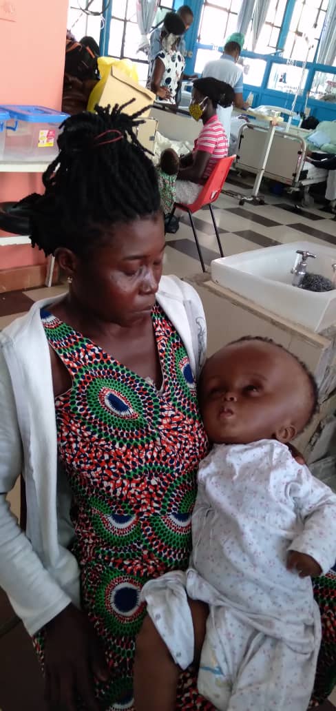 RickmesF's tweet photo. How could I possibly use my own child for rituals, when I can't even fund his own surgery. Yes, he is a  #hydrocephalus boy, but it's not my fault. He is just a victim of the circumstance he has found himself but I can't throw him away.#stopstigmatisingchildrenwithhydrocephalus https://t.co/ilOVWetx1W
