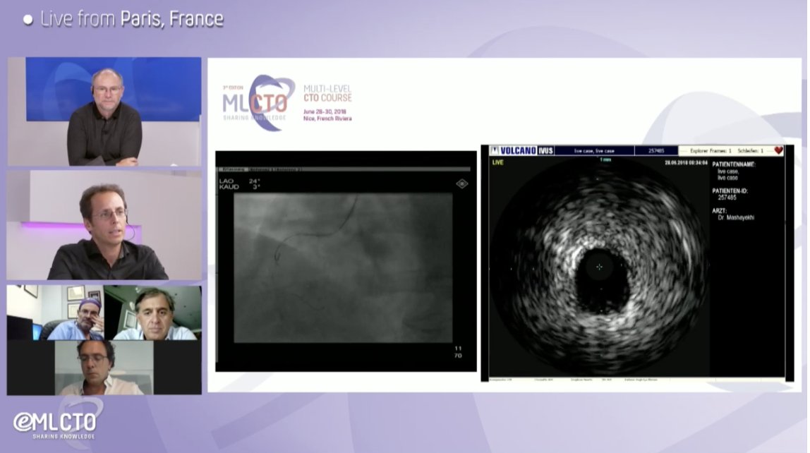 MLCTOAcademy's tweet photo. Still on time to join us! https://t.co/k5sXNx7obA

#eMLCTO2020 #Cardiology #cardiologist #cto #pci https://t.co/HATtQ2MJ8b
