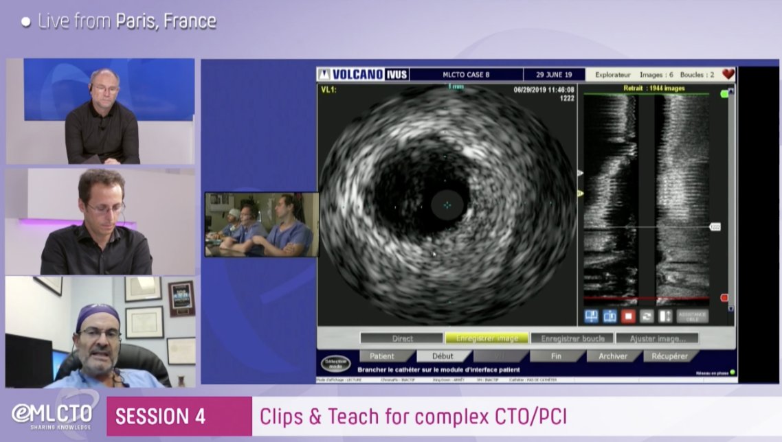 MLCTOAcademy's tweet photo. ➡️ Clips &amp; teach for complex #CTO #PCI! Head now to https://t.co/k5sXNx7obA

#cardiology #cardiologist #cto #pci #eMLCTO https://t.co/xXwodXHe1S