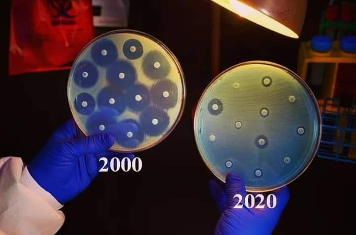 When I was a Medical Technology/Medical Laboratory Scientist intern, we deal with cultures such as these. This picture shows how ineffective antibiotics are to current infections. A less clearing zone means more resistance to antibiotics.