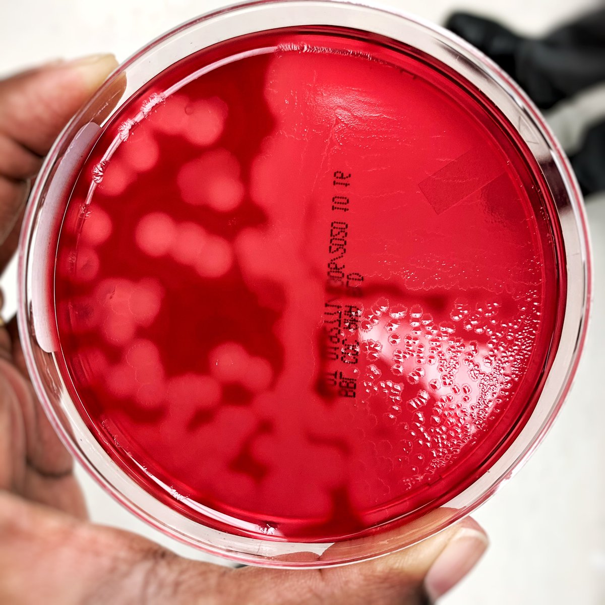 SCherianMicro's tweet photo. Going into the long weekend, can we all just stop to appreciate the double-zones of hemolysis made by this lovely anaerobe? (Which anaerobe?) #MicroRounds #IDMedEd #ClinMicroLab #Pathpearls https://t.co/KHTsgbE1Vt