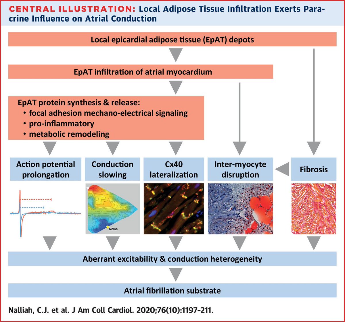 JACCJournals's tweet photo. Clinical studies have reported that epicardial adipose tissue accumulation is associated with the progression of #AFib pathology and adversely affects management. Learn more about the underlying mechanisms in #JACC. https://t.co/RxiwsB06Av https://t.co/DC3GEnqtEP