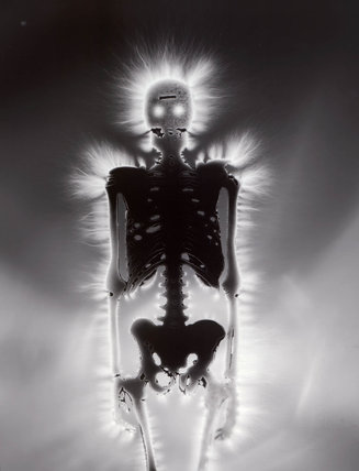 a human skeleton: note that dead objects have a Kirlian aura, too.