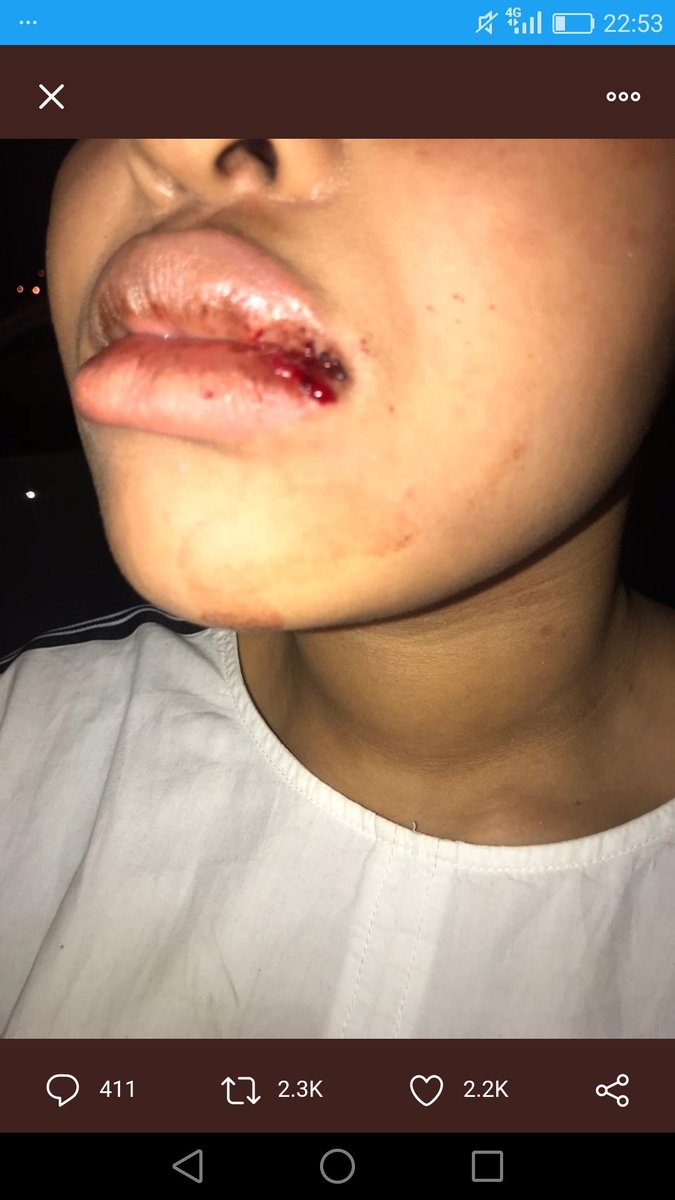 Destiny0221's tweet photo. Mbali is safe and clean check here top no blood she is an attention seeker https://t.co/pGR7aGFWXM