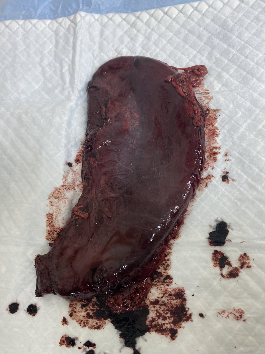 2nd case of FLASH  INGESTION  within one month!!!!
Totally gastric damage!!!📛