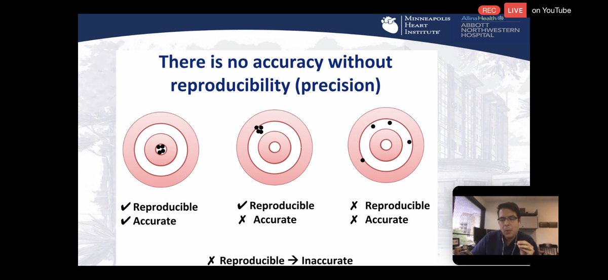 2/Limitations of  #echofirst:overestimation of MR by PISA, underestimation of eccentric MR. poor reproducibility if MR severity (inter- and intra-observer)Alas, there is no accuracy without reproducibility 