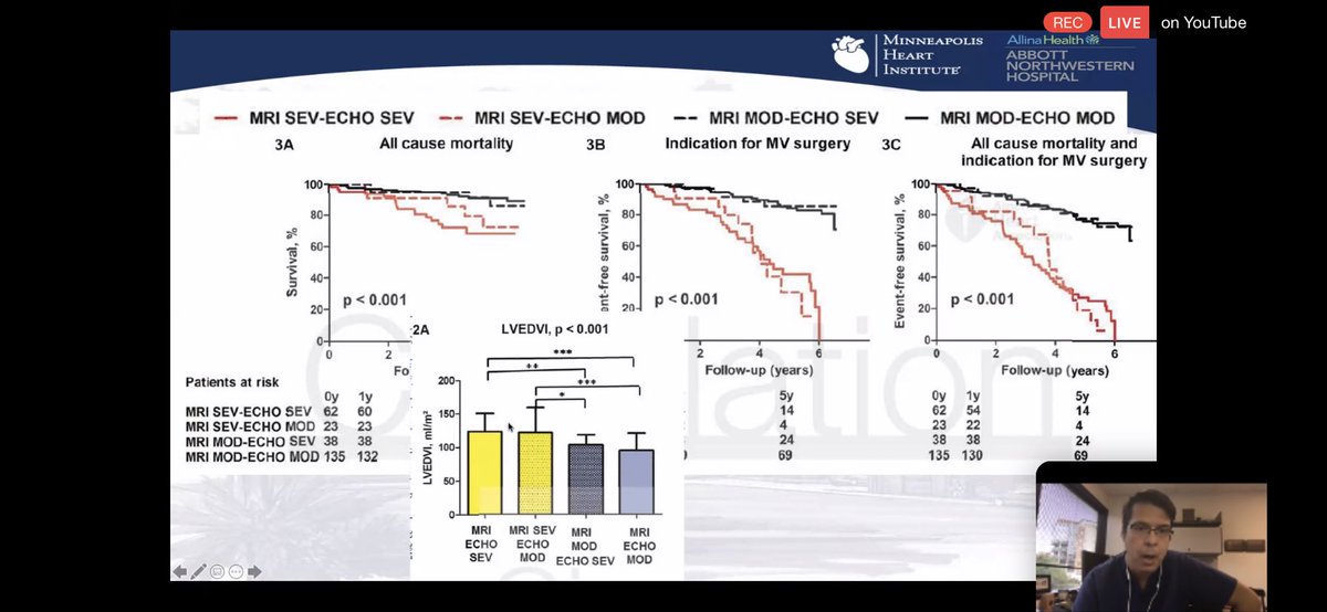 3/  #WhyCMR for Primary MRCIRC ‘17CMR severe-TTE moderate MR outcomes similar to CMR severe-TTE-severe MR.JACC ‘15correlation of MR estimates by  #WhyCMR &  #echofirst in pts referred to MV Sx. correlation b/w post-op LV remodeling & baseline MR severity by CMR