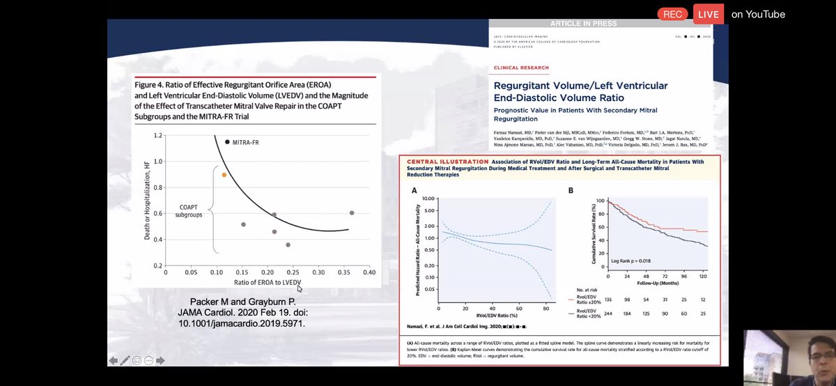 6/ #WhyCMR in FMR:ongoing attempts at quantifying & characterizing significant FMR to help triage patients for appropriate therapies.FMR is a dz of the LV. Need better assessment of LV “health” and  #echofirst with abundant limitations in this regard. Enter  #WhyCMR