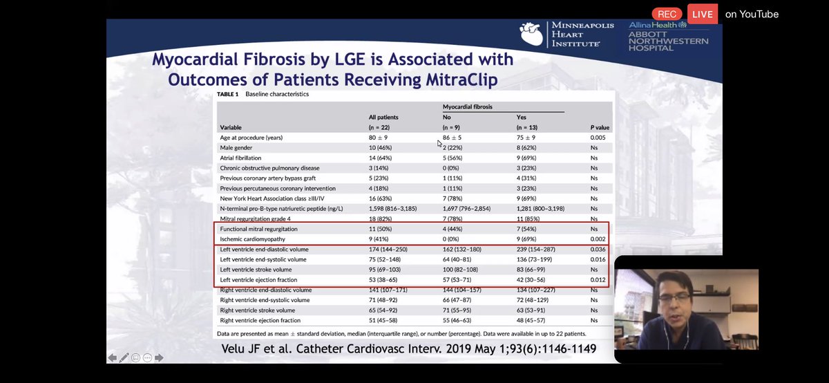 8/Catheter Cardiviasc Interv. 2019MF by  #WhyCMR LGE also a/w post  #mitraclip adverse outcomes.