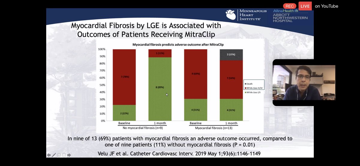 8/Catheter Cardiviasc Interv. 2019MF by  #WhyCMR LGE also a/w post  #mitraclip adverse outcomes.