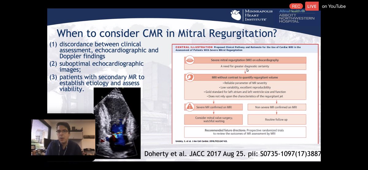 10/In conclusion: Use  #WhyCMR when discordance b/w clinical and echo Doppler findings OR suboptimal echo images OR pts with FMR to establish etiology and assess scar burden. Growing role for  #WhyCMR given reproducibility, prediction of LV remodeling and diagnosing MF.