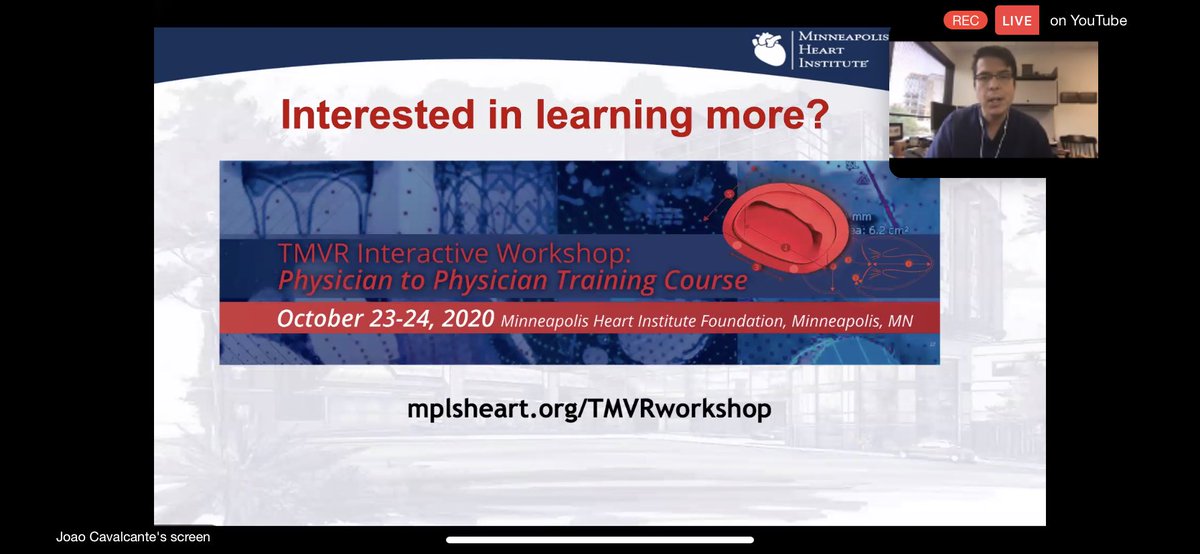 11/ Thanks very much, Dr.  @JoaoLCavalcante for such a detailed talk, from basics to more advanced and for answering my question about 3D ECHO. Those interested in learning more, check out this upcoming workshop by  @MHIF_Heart.