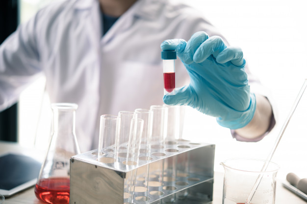 CSL_spain's tweet photo. 🩺👩‍⚕️ El #DeficitDeHierro conduce a una serie de alteraciones de las funciones vitales con su correspondiente morbilidad. La #anemia ferropénica es la más frecuente y afecta aproximadamente al 15% de la población mundial. https://t.co/7veIqsztWk #ViforPharmaES https://t.co/Ssn9yTNxpD