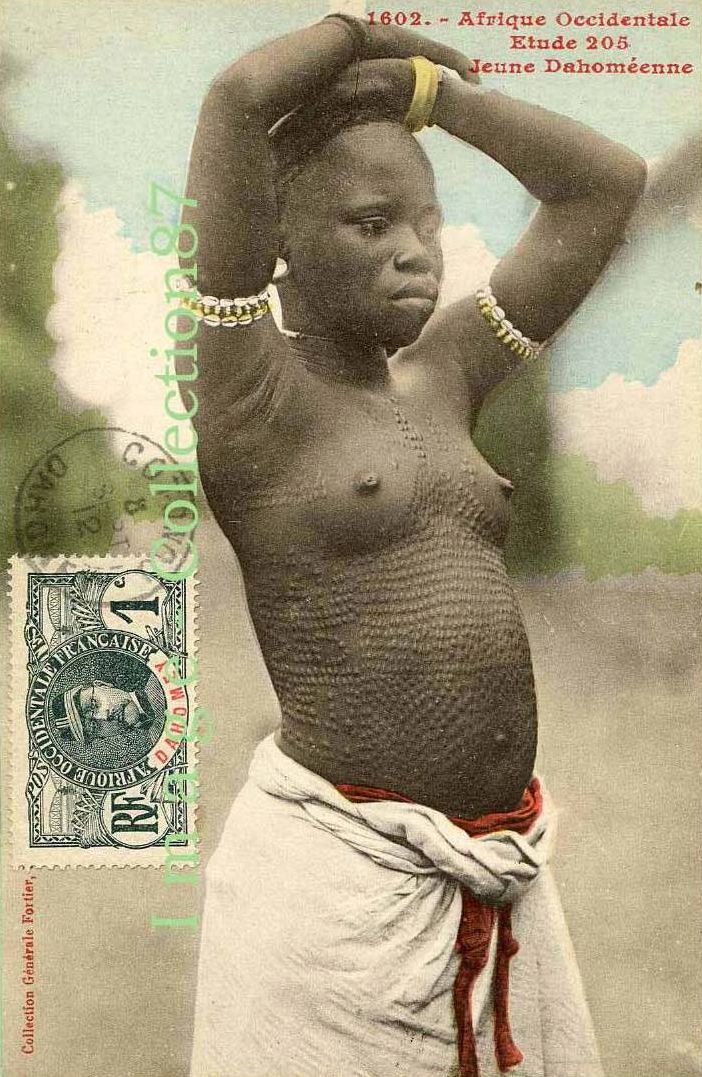 t1/ SCARIFICATION IN AFRICA Sensitive content. Scarification is an ancient African body art that involves purposely scarring the skin to create marks & patterns.  Dahomey Tribal Collection Stamp