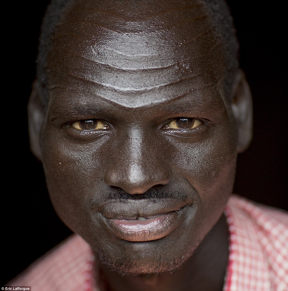 t9/ Reason to Scar; Identification of Tribe/ Family  Nuer Man, Sudan  , with distinctive markings -gaar, which indicates they belong to the tribe & are fierce during conflict.