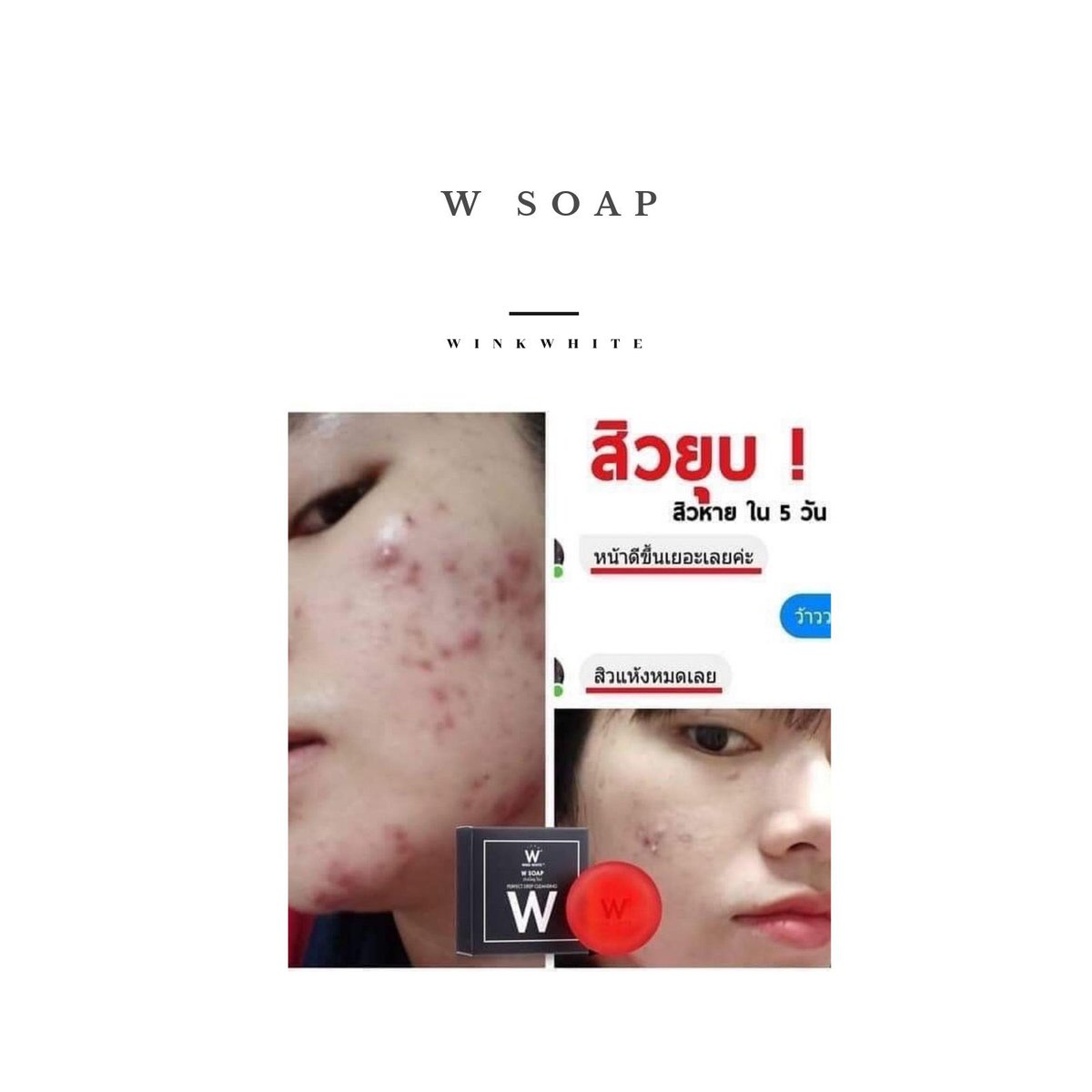Brandwinkwhite's tweet photo. มีก้อนนี้ W soap เอาอยู่ รักษาสิว
และล้างเครื่องสำอางค์บนหน้า
ลดขั้นตอน cleansing ไม่เปลืองสำลี
ก้อนละ 60 บาท
ซื้อ 10 ก้อน แถม 10
#WINKWHITE
#WSOAP
#howtoperfect
#ใช้ดีบอกต่อ
#ถูกและดี
🛒https://t.co/2pqZBUuirS https://t.co/Xfnrps6UAm