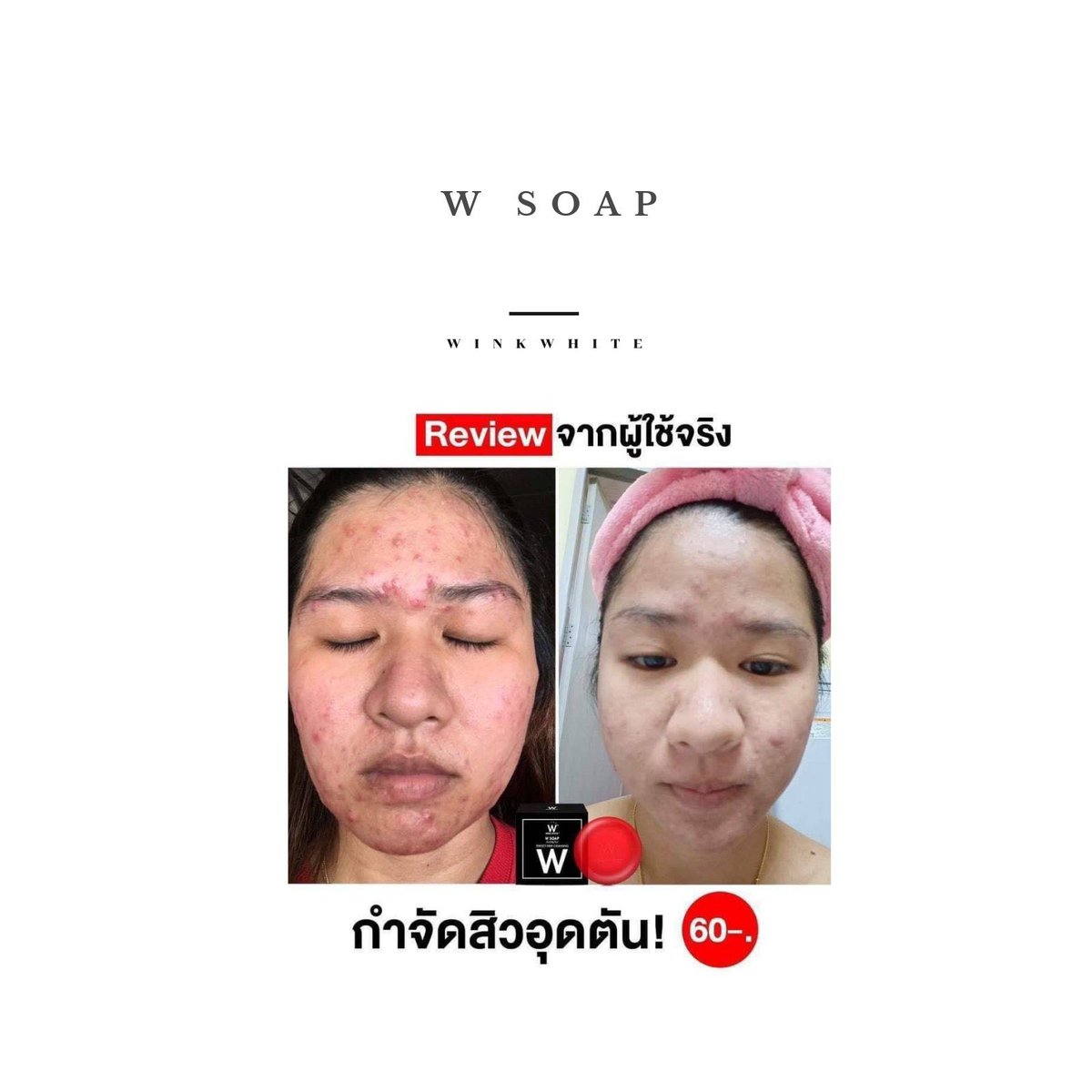 Brandwinkwhite's tweet photo. มีก้อนนี้ W soap เอาอยู่ รักษาสิว
และล้างเครื่องสำอางค์บนหน้า
ลดขั้นตอน cleansing ไม่เปลืองสำลี
ก้อนละ 60 บาท
ซื้อ 10 ก้อน แถม 10
#WINKWHITE
#WSOAP
#howtoperfect
#ใช้ดีบอกต่อ
#ถูกและดี
🛒https://t.co/2pqZBUuirS https://t.co/Xfnrps6UAm