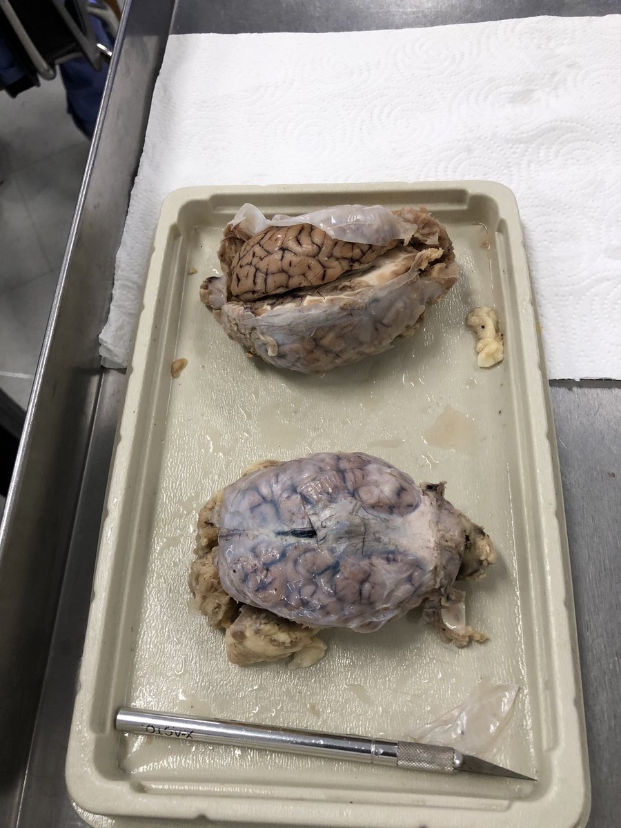 TBSmith1906's tweet photo. I bet your class didn’t dissect a sheep’s brain last week! We get in the weeds early!@SlighMiddle @TitusONeilWWE @SlighPTSA https://t.co/izBLBWGgYW