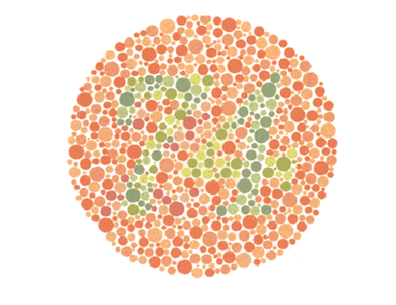for exampe, someone with stargardt's disease would struggle to read this, as the cone cells in the back of their eyes help with processing colours and contrast between them. it can also get worse over time, until it eventually plateaus out, but it is impossible to predict.