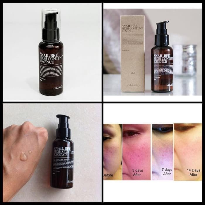 Jiejing_Cos's tweet photo. #พร้อมส่ง
#BENTON #SnailBee High Content Essence 60ml
ดูแลผิวหน้าครบจบในขวดเดียวด้วยเอสเซนส์บำรุงจากเมือกหอยทากและพิษผึ้ง ช่วยให้ผิวเรียบเนียน กระจ่างใส และลดเลือนริ้วรอยที่เกิดก่อนวัย ดูแลผิวหน้าครบจบในขวดเดียว
👉490฿📦30/50
#สกินแคร์เกาหลี
#คสอเกาหลี
#พรีออเดอร์เกาหลี
#ดีบอกต่อ https://t.co/XAn8YWkOto