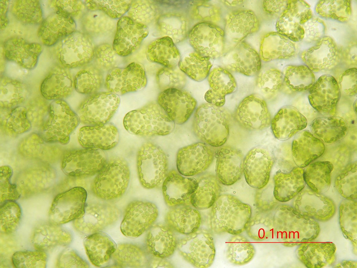 植物顕微鏡写真 趣味 海綿状組織 1カリブラコア属何か 2ブルーベリーの何か 3ツワブキ 4レタス 柵状組織に比べて間隙が多いのは共通特徴ですが 細胞形状は異なります 海綿状組織の役割として一般的に ガス拡散と 光の散乱が上げられますが と の