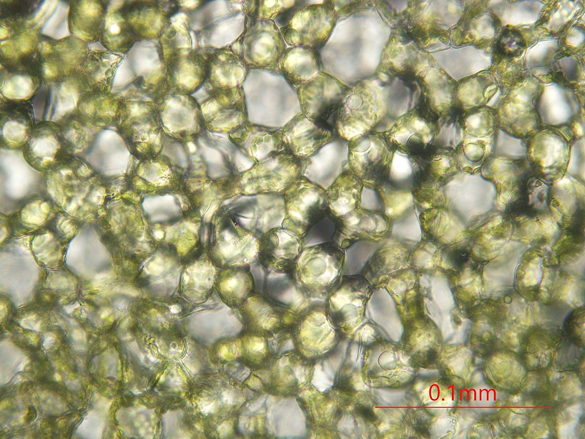 植物顕微鏡写真 趣味 海綿状組織 1カリブラコア属何か 2ブルーベリーの何か 3ツワブキ 4レタス 柵状組織に比べて間隙が多いのは共通特徴ですが 細胞形状は異なります 海綿状組織の役割として一般的に ガス拡散と 光の散乱が上げられますが と の